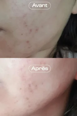 Discount Crème visage rééquilibrante et hydratante Ma Jolie Peau Soin De Jour|Anti-Imperfection & Rougeurs