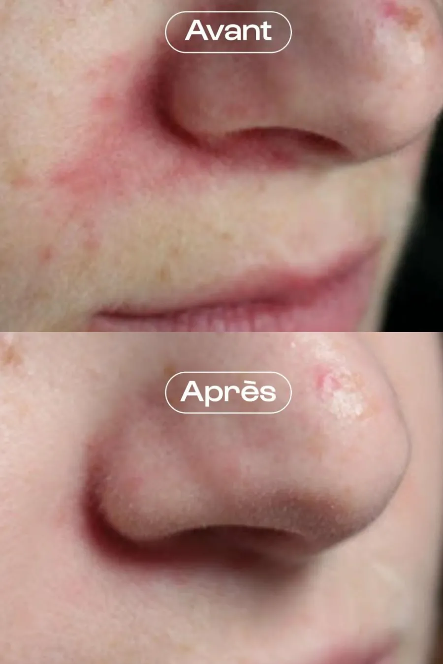Discount Crème visage rééquilibrante et hydratante Ma Jolie Peau Soin De Jour|Anti-Imperfection & Rougeurs
