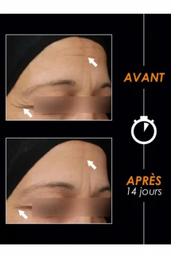 Best La Poudre Magique Eclat & Jeunesse L’Appel de la Forêt à la vitamine C Soin De Jour|Sérum & Huile