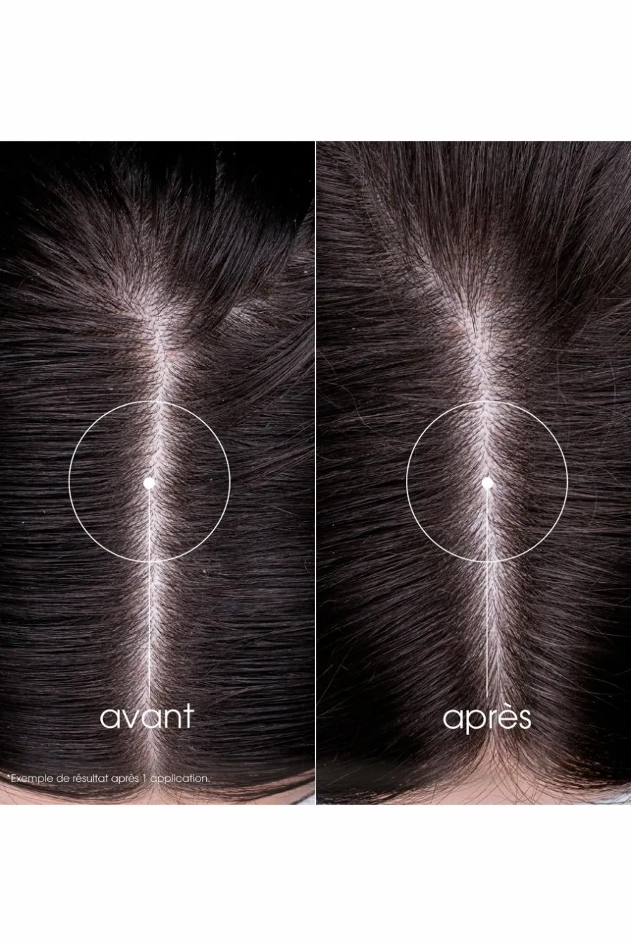 Shampoing fortifiant à la Quinine & Edelweiss bio Shampoing