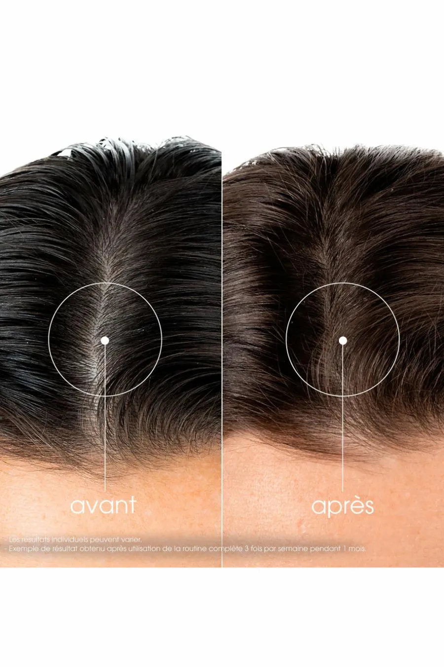 Shampoing fortifiant à la Quinine & Edelweiss bio Shampoing