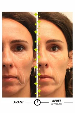 Sale Sérum anti-âge Mystérieux Repulpant® Contour Des Yeux & Lèvres|Soin De Jour