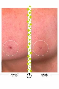 Sale Sérum anti-imperfections concentré Elixir du Marabout® Sérum|Anti-Imperfection & Rougeurs